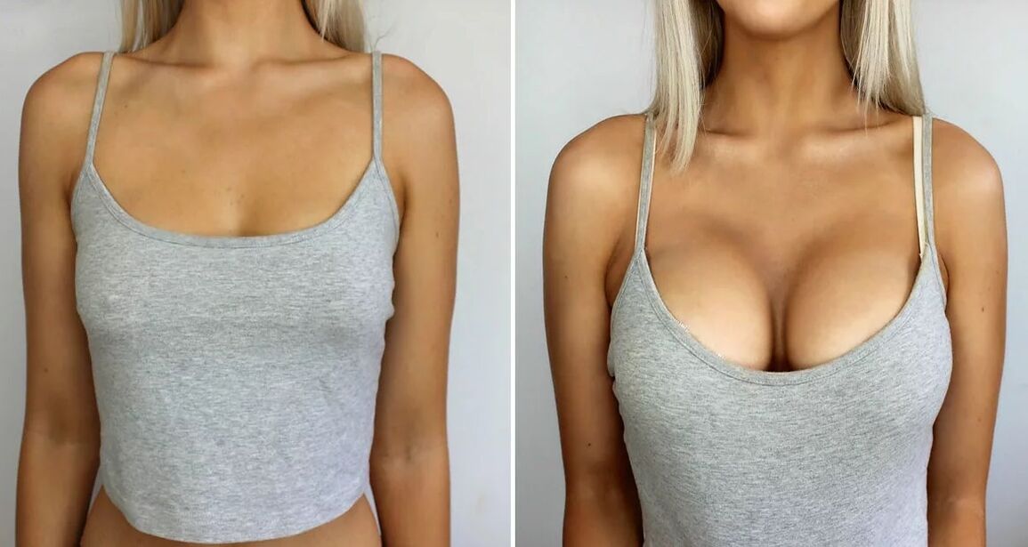 Breast zoom 3 size