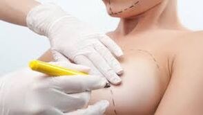 Breast zoom operation